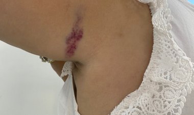 Homem agride funcionária de farmácia após “surtar”
