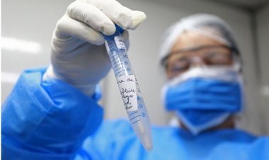 Casos de Covid aumentam 125% em todo o estado