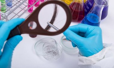 Menos de 10 dias de prazo para fazer teste