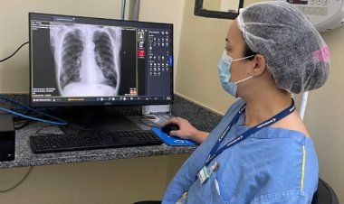 SAÚDE PÚBLICA - Minas Gerais registra mais de 4 mil casos de tuberculose