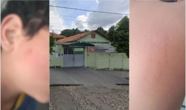 Menino de 11 anos é agredido a pauladas em uma escola de Divinópolis