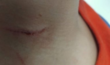 Homem é preso em Divinópolis por agredir criança  com objeto cortante