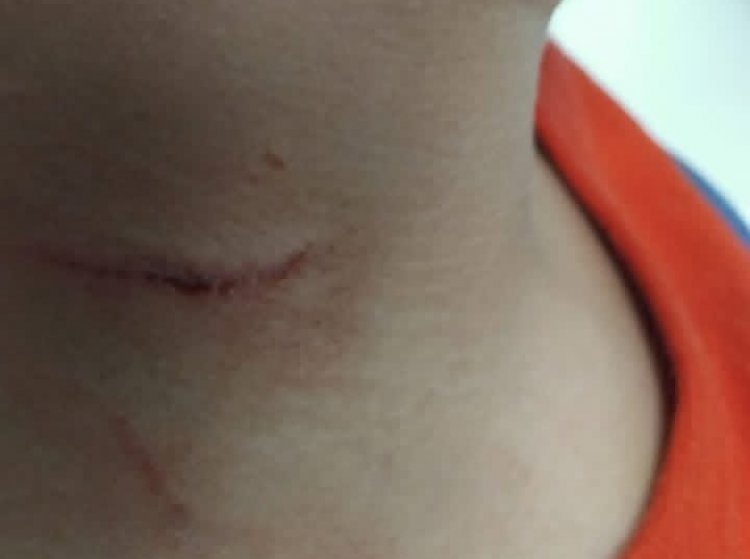 Homem é preso em Divinópolis por agredir criança com objeto cortante