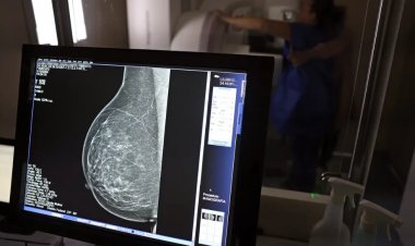 SAÚDE FEMININA - Mamografia para mulheres de 40 a 49 anos