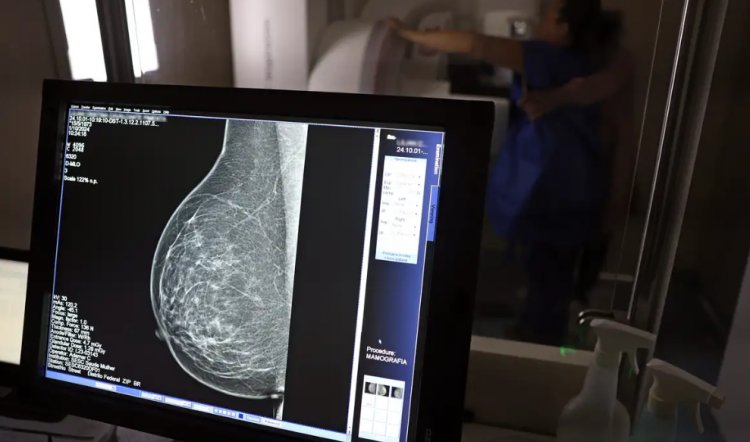 SAÚDE FEMININA - Mamografia para mulheres de 40 a 49 anos