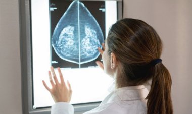 OUTUBRO ROSA - Mulheres de 40 a 49 anos têm  direito à mamografia no SUS