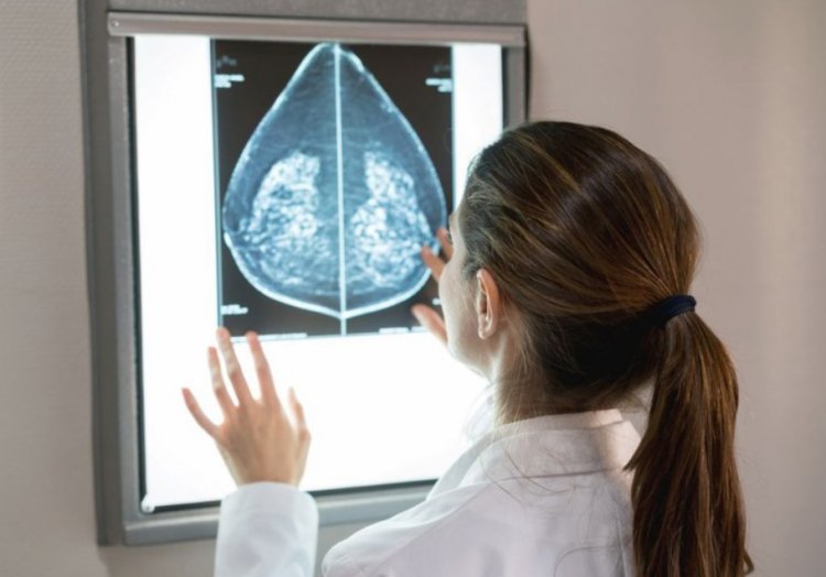 OUTUBRO ROSA - Mulheres de 40 a 49 anos têm  direito à mamografia no SUS