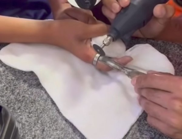 Criança de 11 anos com anel preso no dedo é socorrida pelos Bombeiros em Itaúna