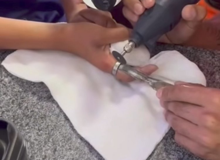 Criança de 11 anos com anel preso no dedo é socorrida pelos Bombeiros em Itaúna