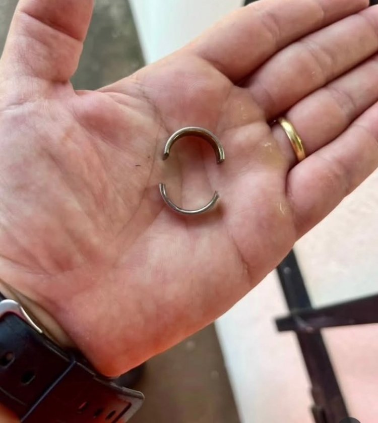 Criança de 11 anos com anel preso no dedo é socorrida pelos Bombeiros em Itaúna