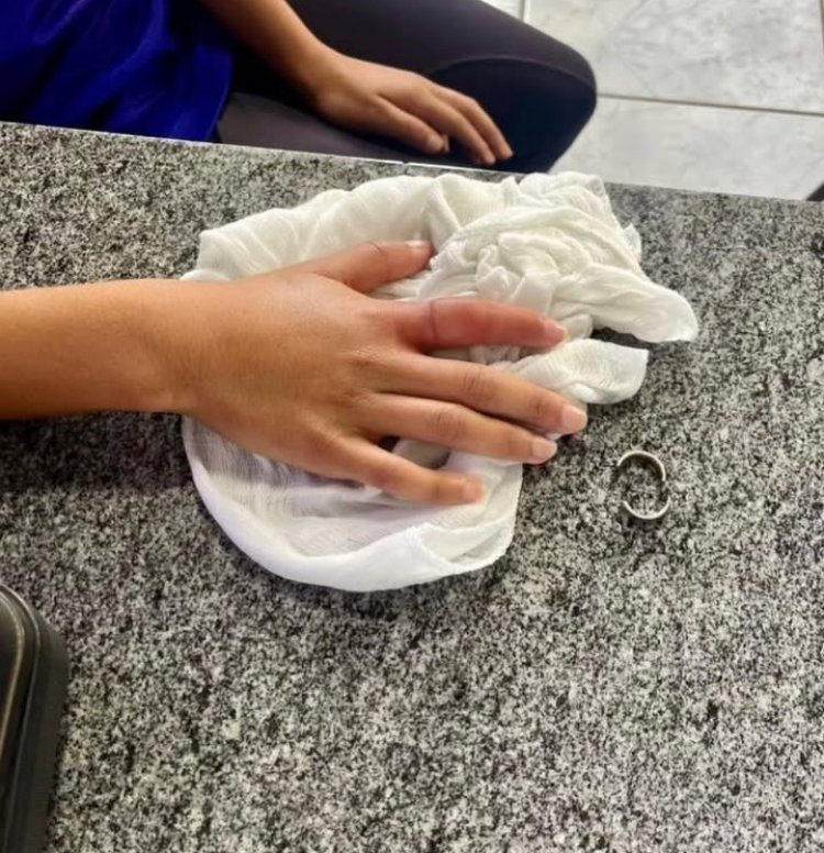 Criança de 11 anos com anel preso no dedo é socorrida pelos Bombeiros em Itaúna